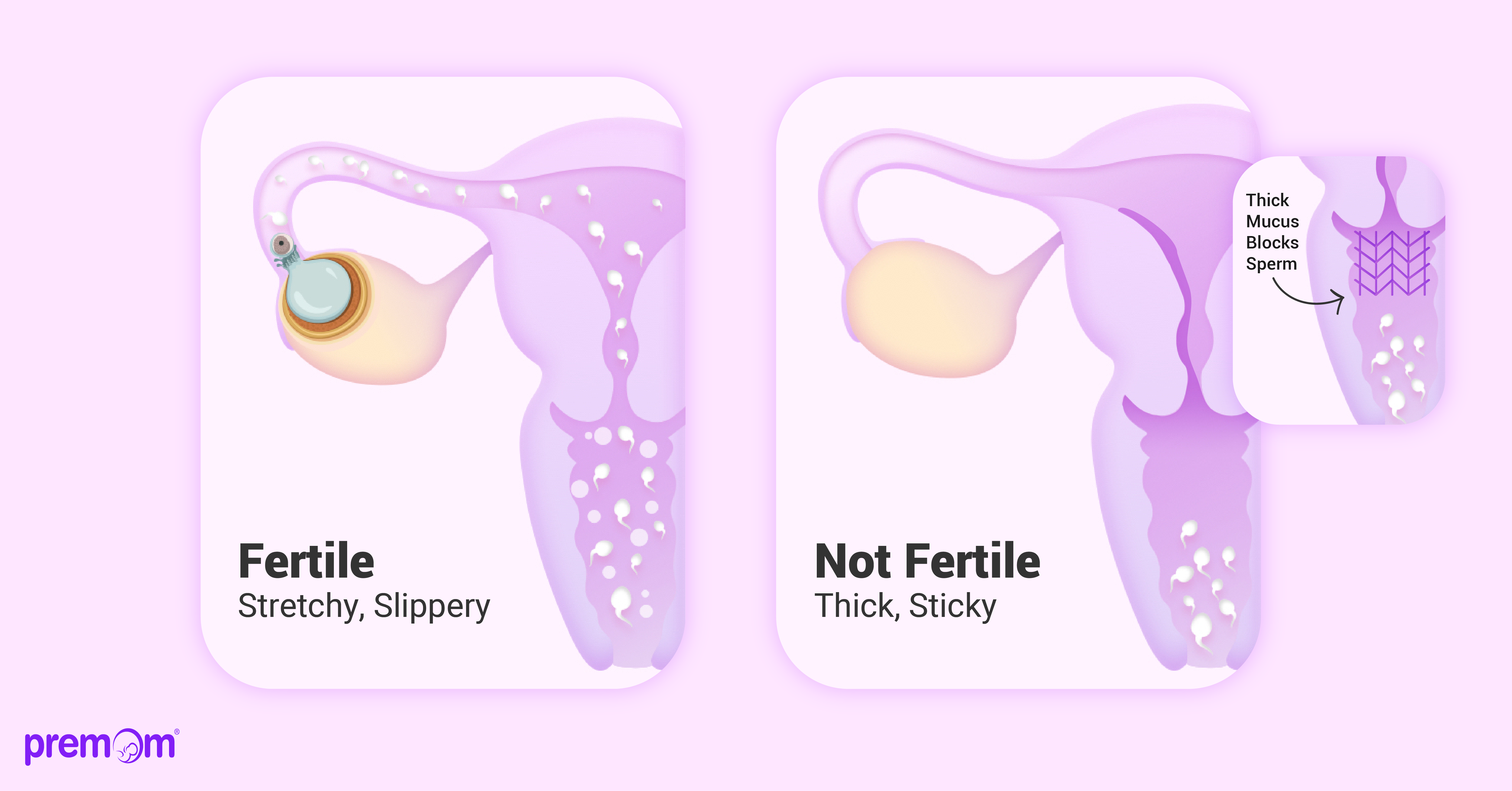 Fertile cervical mucus vs infertile