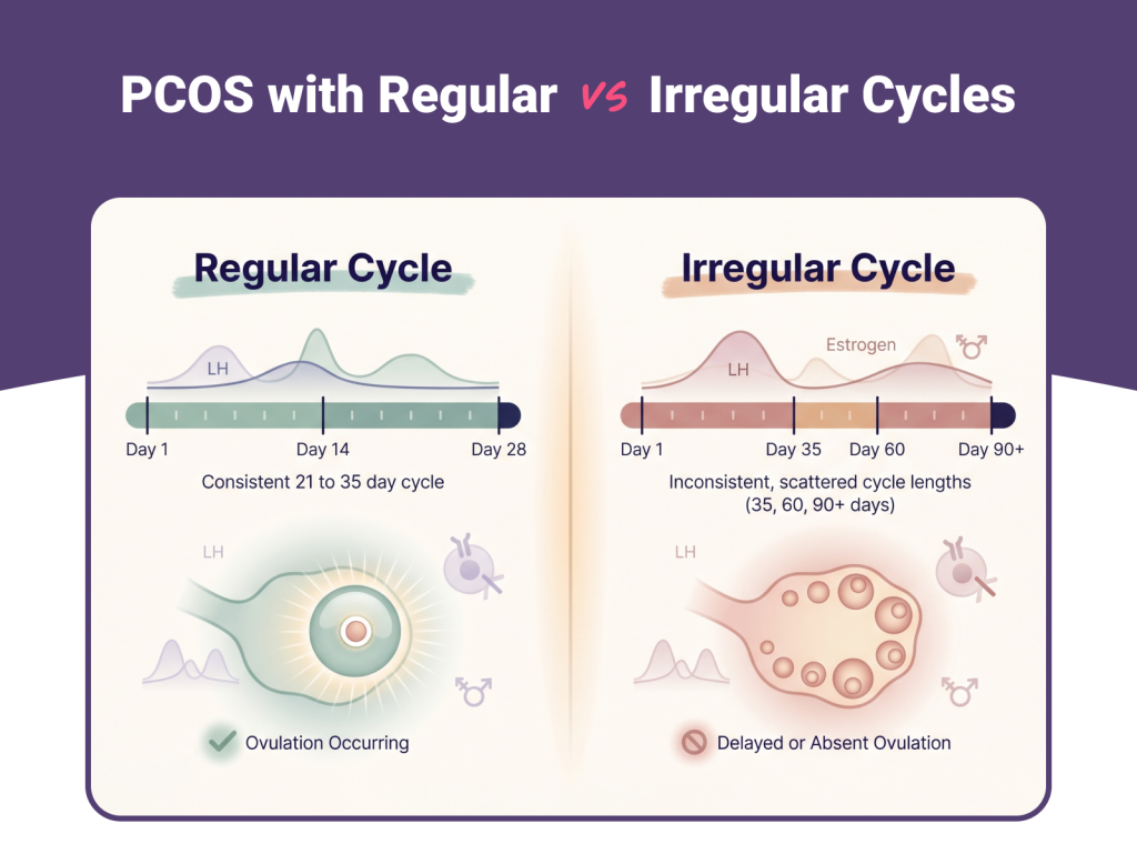 PCOS with Regular vs Irregular Cycles