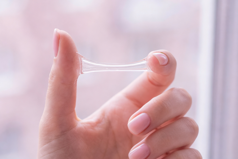 PCOS Cervical Mucus: Can It Predict Ovulation? What to Look For