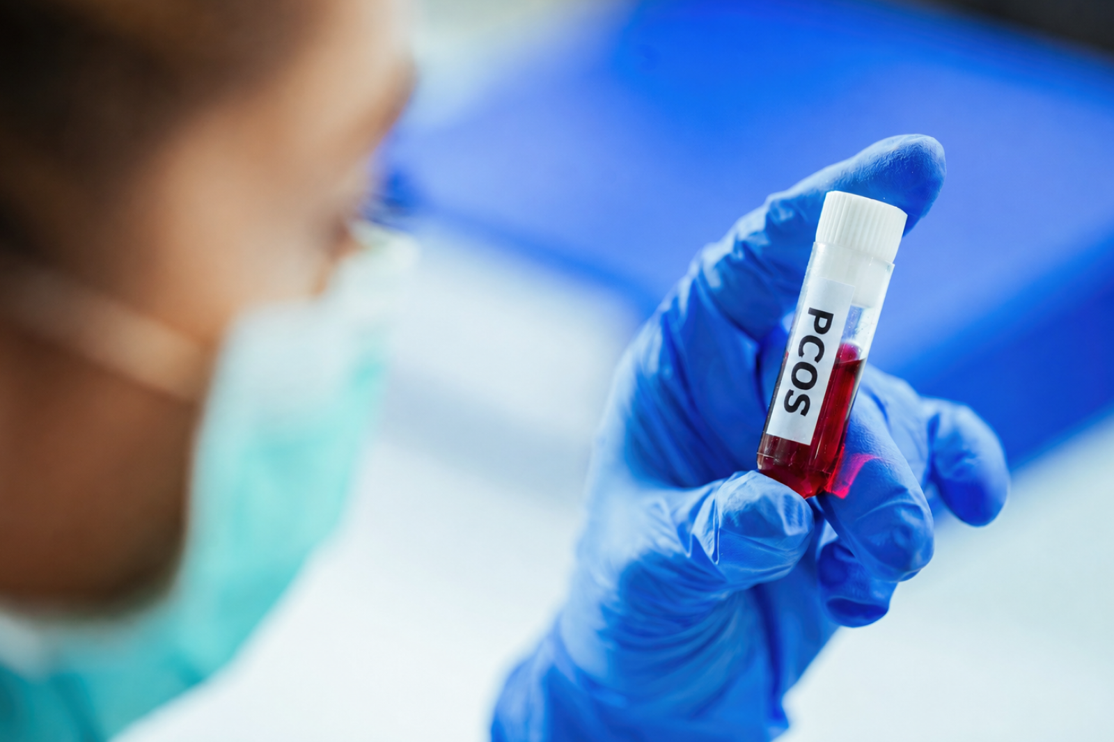 PCOS Blood Tests: What to Ask Your Doctor For